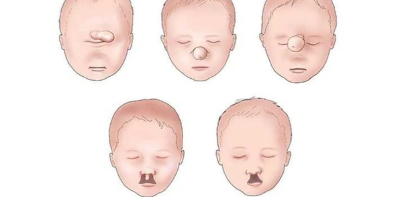 Hôn nhân cận huyết có thể dẫn đến nhiều hậu quả nghiêm trọng cho đứa trẻ sinh ra